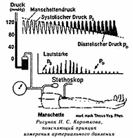 korotkoff sounds